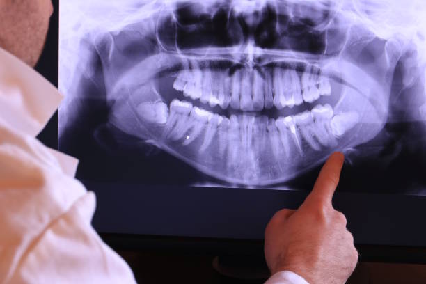 Best Emergency Treatment for Toothache in Landing, NJ
