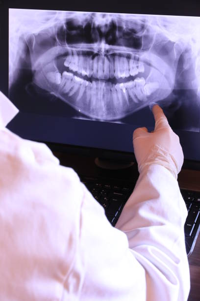 Best Emergency Tooth Extraction in Landing, NJ