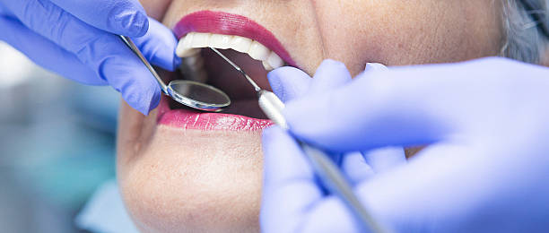 Best Emergency Treatment for Toothache in Landing, NJ