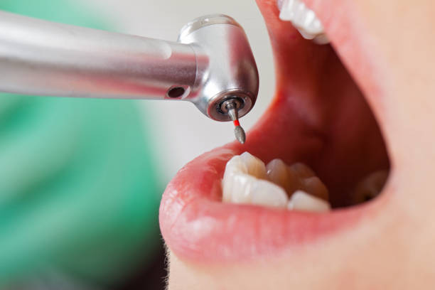 Best Emergency Treatment for Toothache in Landing, NJ